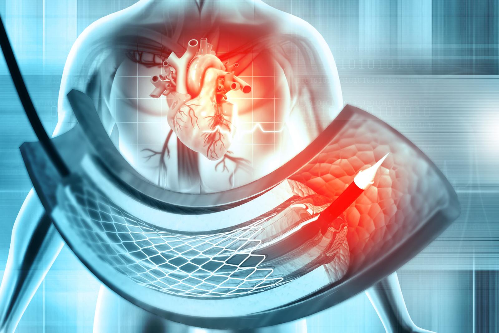 Novità in campo cardiologico all’Ospedale Koelliker: si esplorano le profondità del cuore con l’ecocardiogramma transesofageo per via endoscopica