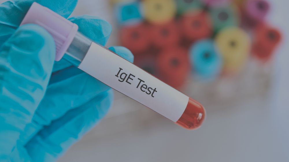ISAC - Test molecolare per la diagnosi delle allergie