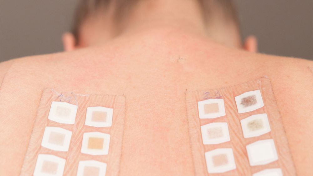 Patch Test