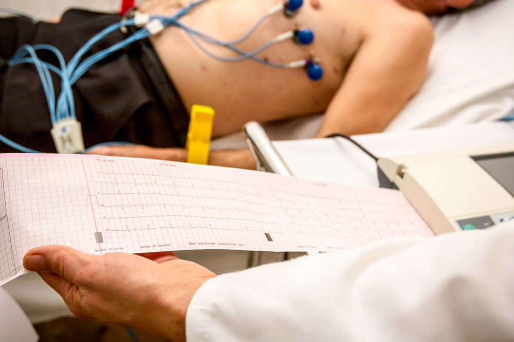 Elettrocardiogramma - ECG