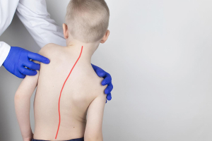 Sabato 8 giugno - Giornata della scoliosi, promuoviamo la prevenzione della scoliosi